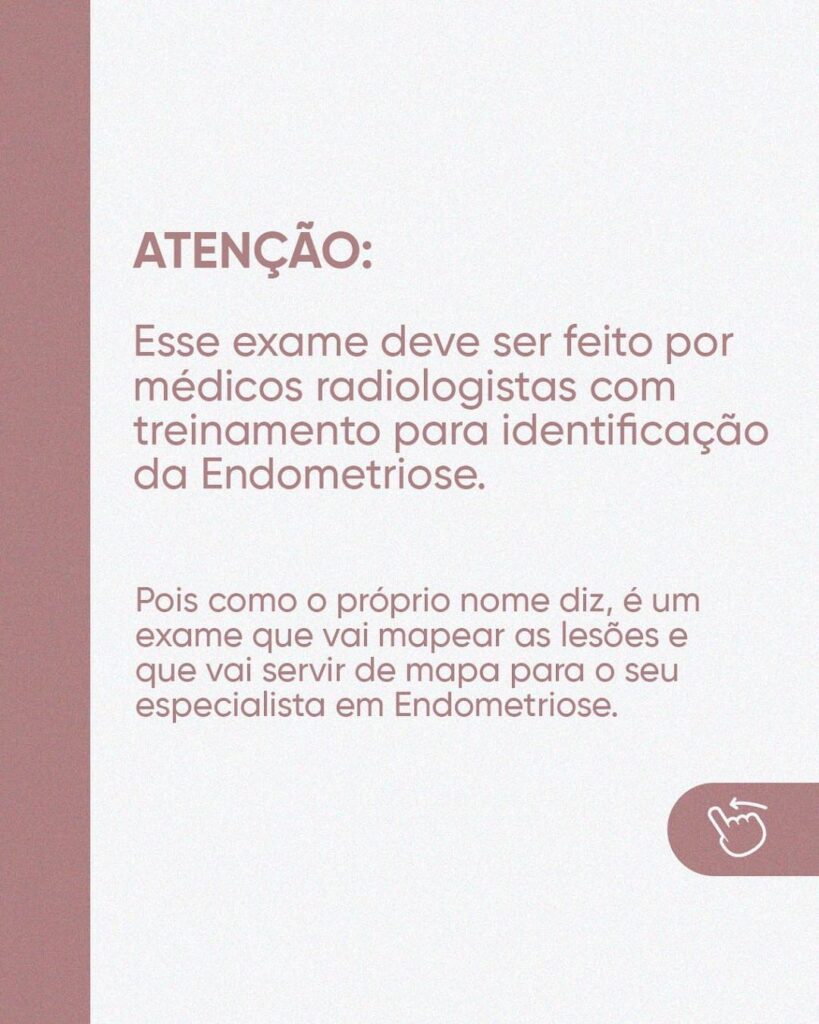 exame de mapeamento da endometriose